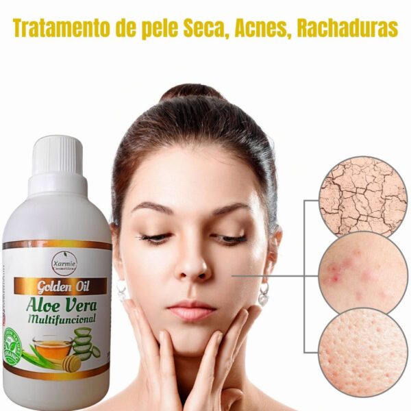 Óleo de Aloe Vera Babosa para Pele com Psoríase - Regeneração e Cuidado 100ml Natural - Image 6