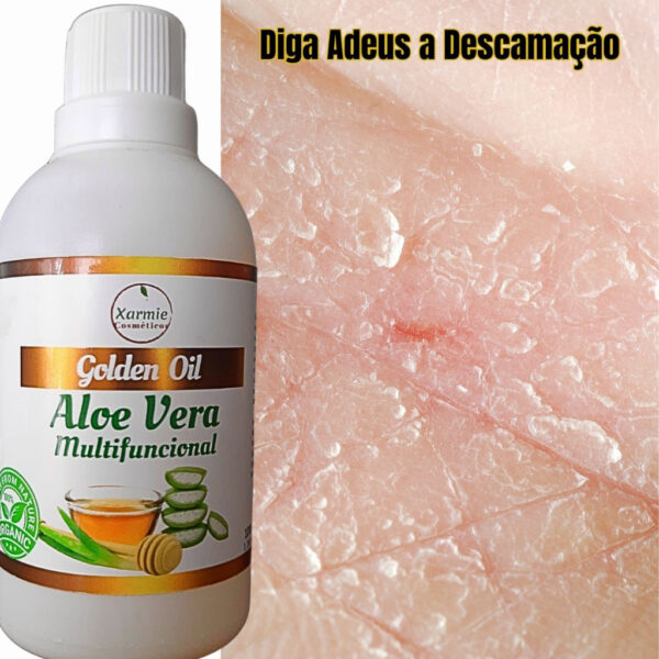 Óleo de Aloe Vera Babosa para Pele com Psoríase - Regeneração e Cuidado 100ml Natural - Image 5