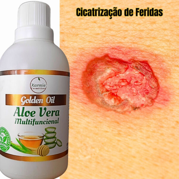 Óleo de Aloe Vera Babosa para Pele com Psoríase - Regeneração e Cuidado 100ml Natural - Image 4